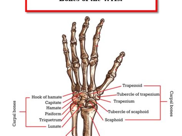Can golf hurt your wrist?