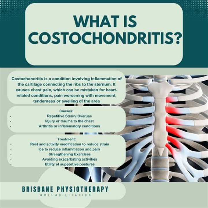 Can muscle relaxers help costochondritis?
