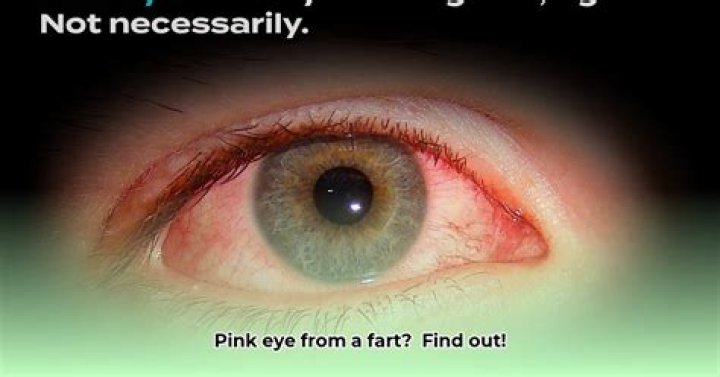 Can you get pink eye from a fart?