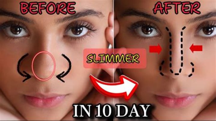 How can I reduce my tummy after 3 months?