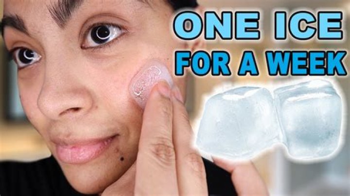 Is ice good for pimples?