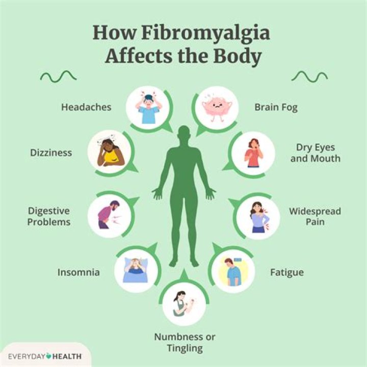 What can be mistaken for fibromyalgia?
