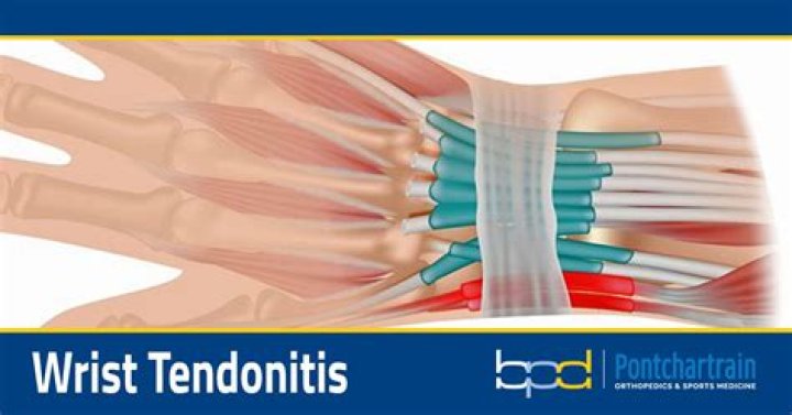 What can I rub on tendonitis?