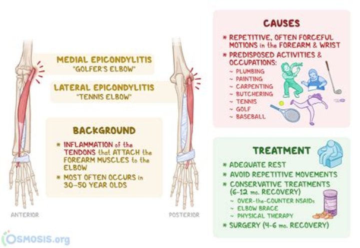 What swing causes golfers elbow?