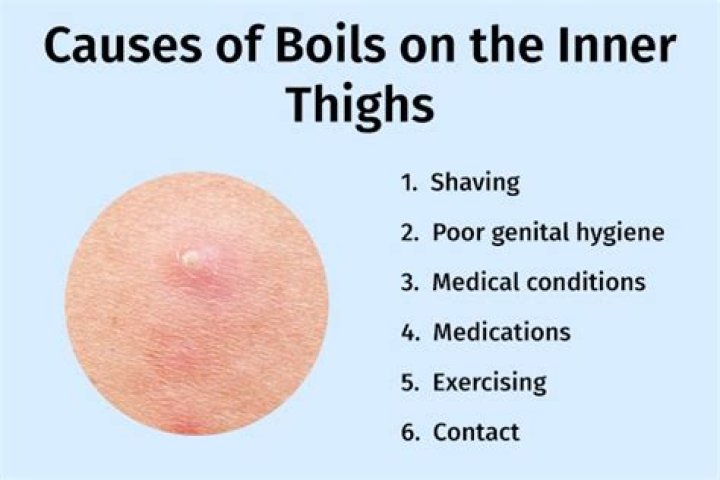 Why does the inside of my thigh smell?